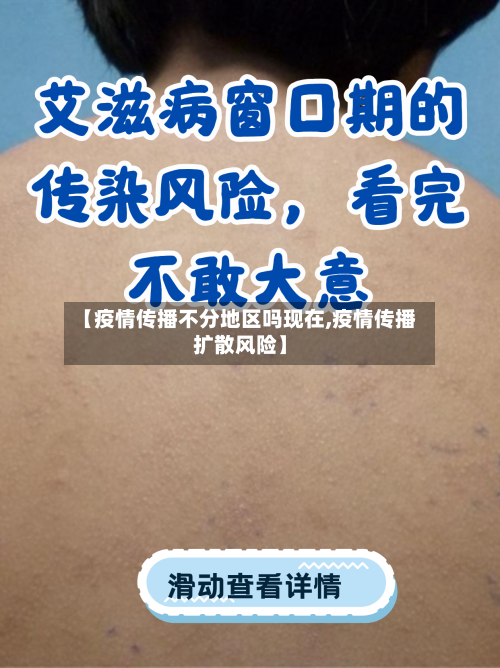【疫情传播不分地区吗现在,疫情传播扩散风险】-第1张图片