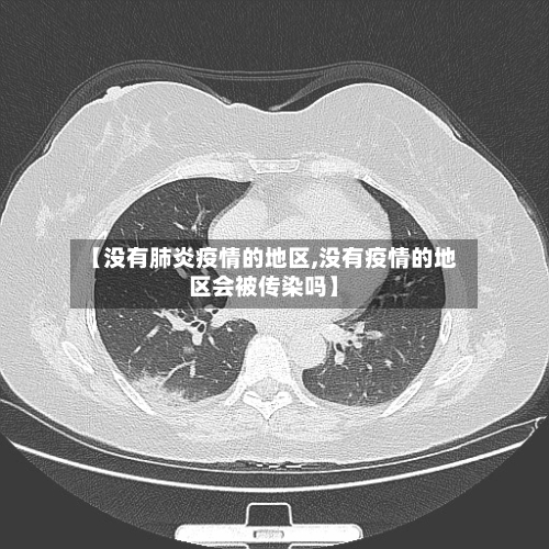 【没有肺炎疫情的地区,没有疫情的地区会被传染吗】-第1张图片