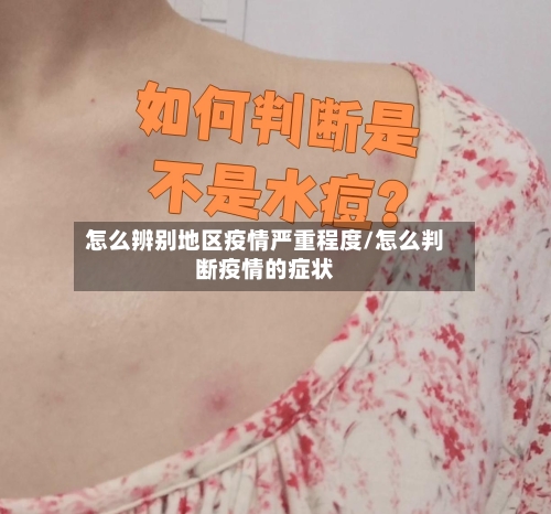 怎么辨别地区疫情严重程度/怎么判断疫情的症状-第1张图片